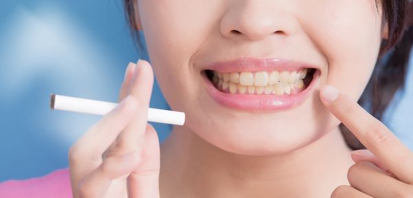 Zahn dicke op nach backe Patientenfrage: Plötzlich