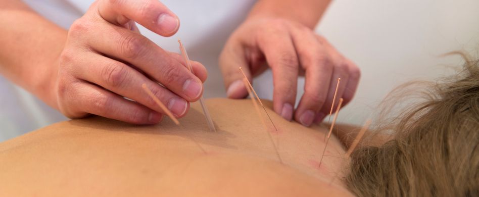 Akupunkturpunkte finden: Hier werden die Nadeln angesetzt