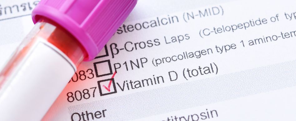 Vitamin-D-Test: Wie funktioniert er?