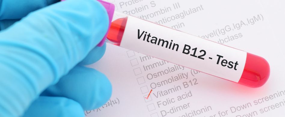 Vitamin B12-Test: Kosten, Werte, Notwendigkeit