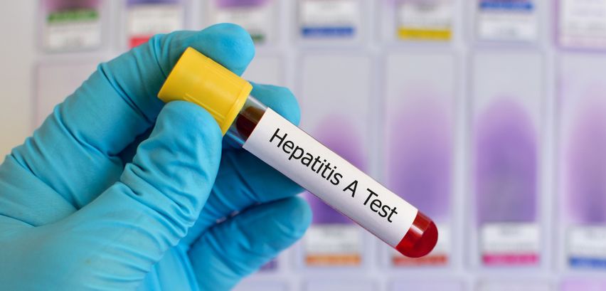 Hepatitis A: Symptome und Ansteckung