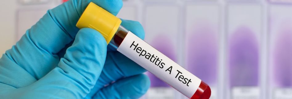 Hepatitis A Symptome Und Ansteckung