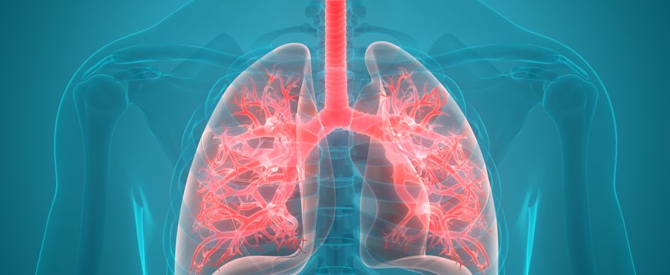 Grafik entzündete Lunge