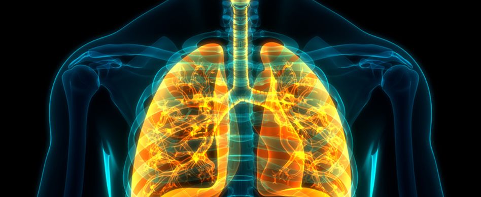 Röntgenbild von Lunge